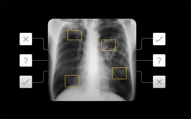 Google desenvolve algoritmos de IA que podem diagnosticar doenças dermatológicas e tuberculose