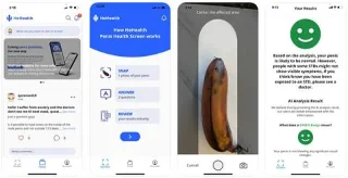 Les applications d’IA peuvent diagnostiquer les maladies sexuellement transmissibles uniquement grâce aux images
