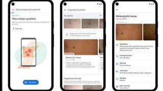 Google desenvolve algoritmos de IA que podem diagnosticar doenças dermatológicas e tuberculose