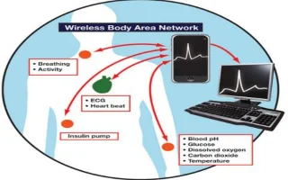 Qu’est-ce que le WBAN (Wireless Body Area Network)&nbsp;?
